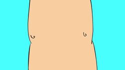 How to Get Male Breast Reduction Surgery Instructional Video