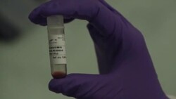 CLEAN : French scientists study sea worm for use in human transplants News Clip