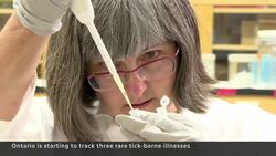 Ontario is now tracking three additional tick-borne illnesses News Clip