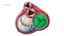 Trikuspidalklappe Instructional Video
