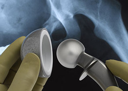 Los metales y la medicina Instructional Video