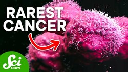 The Rarest Cancer on Earth: Only One Known Case Instructional Video