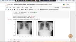 Evaluate the impact of an AI application used in the real world. (case study) : Introduction Instructional Video