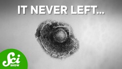 How Does Chickenpox Turn Into Shingles? Instructional Video