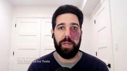 Challenges with COVID-19 testing access affects accuracy of case counts News Clip