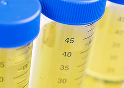 Why is urine yellow? Instructional Video