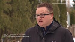 Seattle Kraken fan awarded $10,000 scholarship after spotting Canucks staffer's cancerous mole News Clip