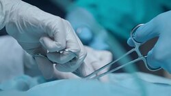 Surgery operation. Doctor hand care wound. Medical operation. Surgery tools Stock Footage