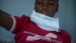 The Deadly Combination: The New TB Epidemic Instructional Video