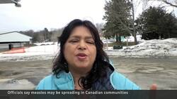 Potential community spread of measles worries health officials News Clip
