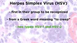 Herpes Simplex Virus (HSV-1 and HSV-2) Instructional Video