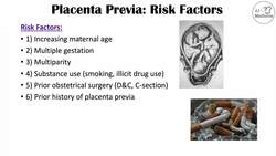 Placenta Previa (Low Lying Placenta) | Risk Factors, Symptoms & Complications, Diagnosis, Treatment Instructional Video