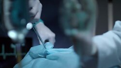 Surgeon patient breath oxygen mask during operation. Surgeons operating Stock Footage