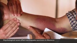 Moroccans in earthquake zone living in tents News Clip