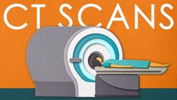 WHAT IS A CT SCAN and why do we need it Instructional Video