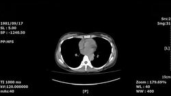 medical ct scan Stock Footage