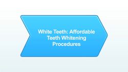 Affordable Teeth Whitening Procedures Instructional Video