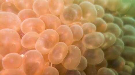 The Secret Life of the Immortal Jellyfish