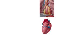 Right coronary artery Instructional Video