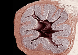 Large Intestine Instructional Video