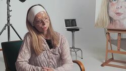 Acid attack survivor Patricia Lefranc fronts new campaign to raise awareness Stock Footage