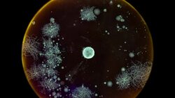 growth of bacteria taken in a bathroom in a Petri dish time lapse Stock Footage