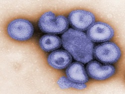 Vida microscópica: ¿qué es un virus? Instructional Video