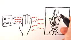 X-Rays _ GCSE Physics Instructional Video