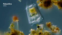 How Do Microorganisms Pee Instructional Video