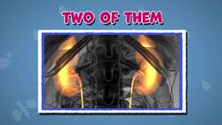 I WONDER - Can You Live With One Kidney? Instructional Video