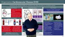 Treatment Options for Cardiovascular Disease Instructional Video