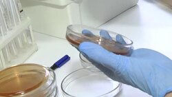Gynecological smear. Laboratory research. Smear on the flora. The smear is applied to the glass and painted with special dyes. Stock Footage
