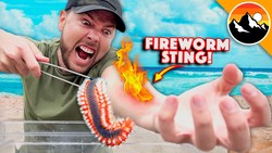 Stung by a Fireworm! Instructional Video