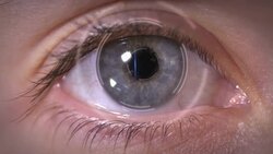 Digital iris scanning for security Stock Footage