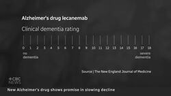 New Alzheimer's drug shows promise in slowing disease News Clip