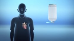 Doctors ‘reanimate’ human heart from deceased donor Instructional Video