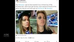 #TheMoment a Jays fan got love from team after taking a foul ball in the face News Clip