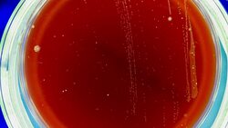 growth of bacteria taken in a bathroom in a Petri dish time lapse Stock Footage