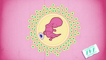 IVF