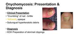 Onychomycosis | Nail Infection | Signs, Symptoms, Treatment Instructional Video