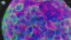 Diabetes & Dogs! NSF Science Now 60 Instructional Video