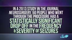 To Heal the Brain, Sometimes We Need to Damage It Instructional Video