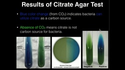 Microbiology: Citrate Agar Instructional Video