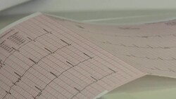 CLEAN : Paris hospital unit helps patients with post-Covid rehabilitation News Clip