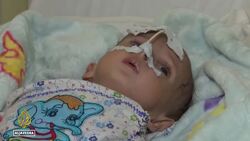 UN: More than one million Afghan children to suffer severe malnut News Clip