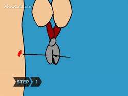 How to Remove Porcupine Quills Instructional Video