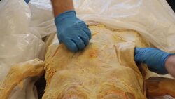 Exploring Female Reproductive Anatomy: Dissecting for the Uterus Instructional Video