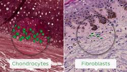 Elastic cartilage Instructional Video