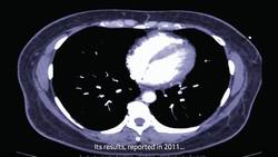 How to detect the deadliest form of cancer Instructional Video