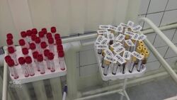 Inside the search for COVID-19 antibodies News Clip